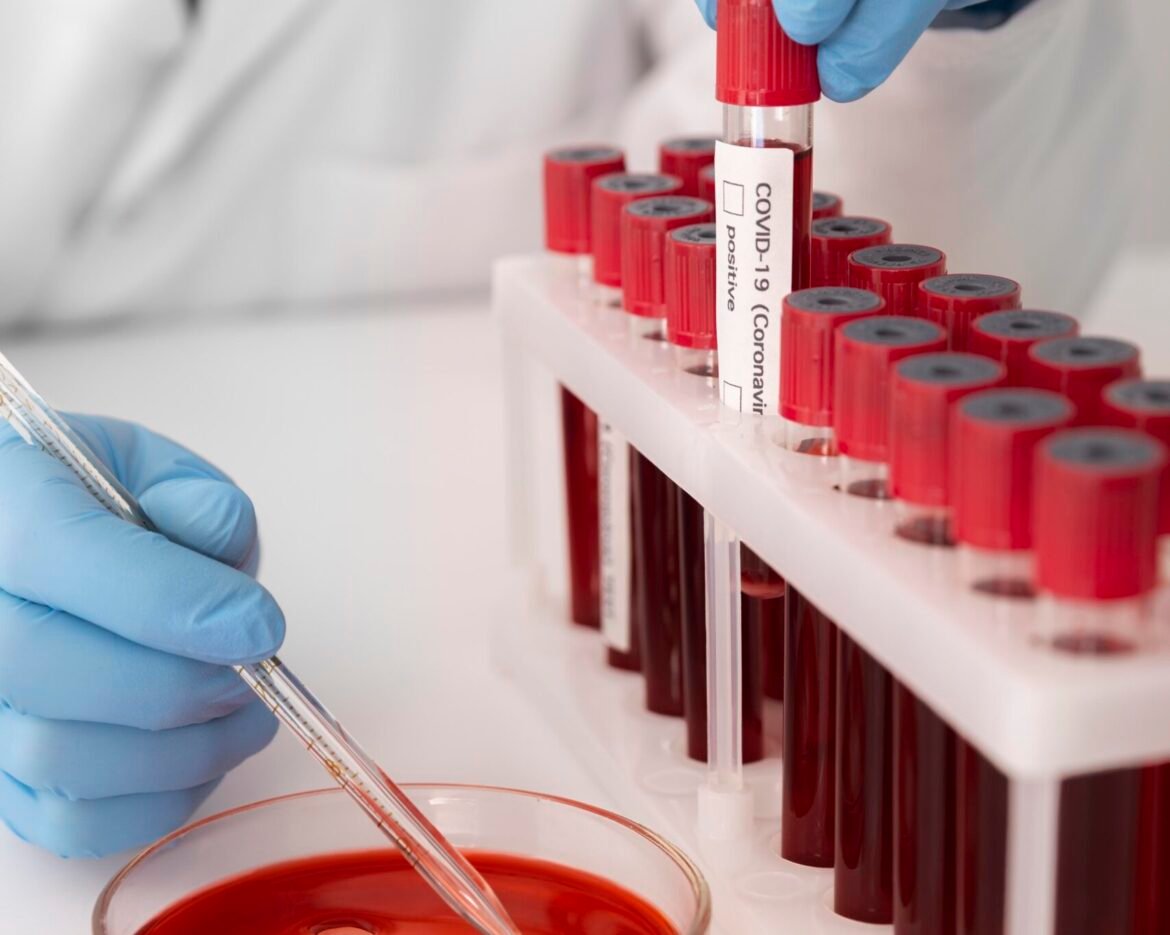 coronavirus-blood-samples-arrangement-lab