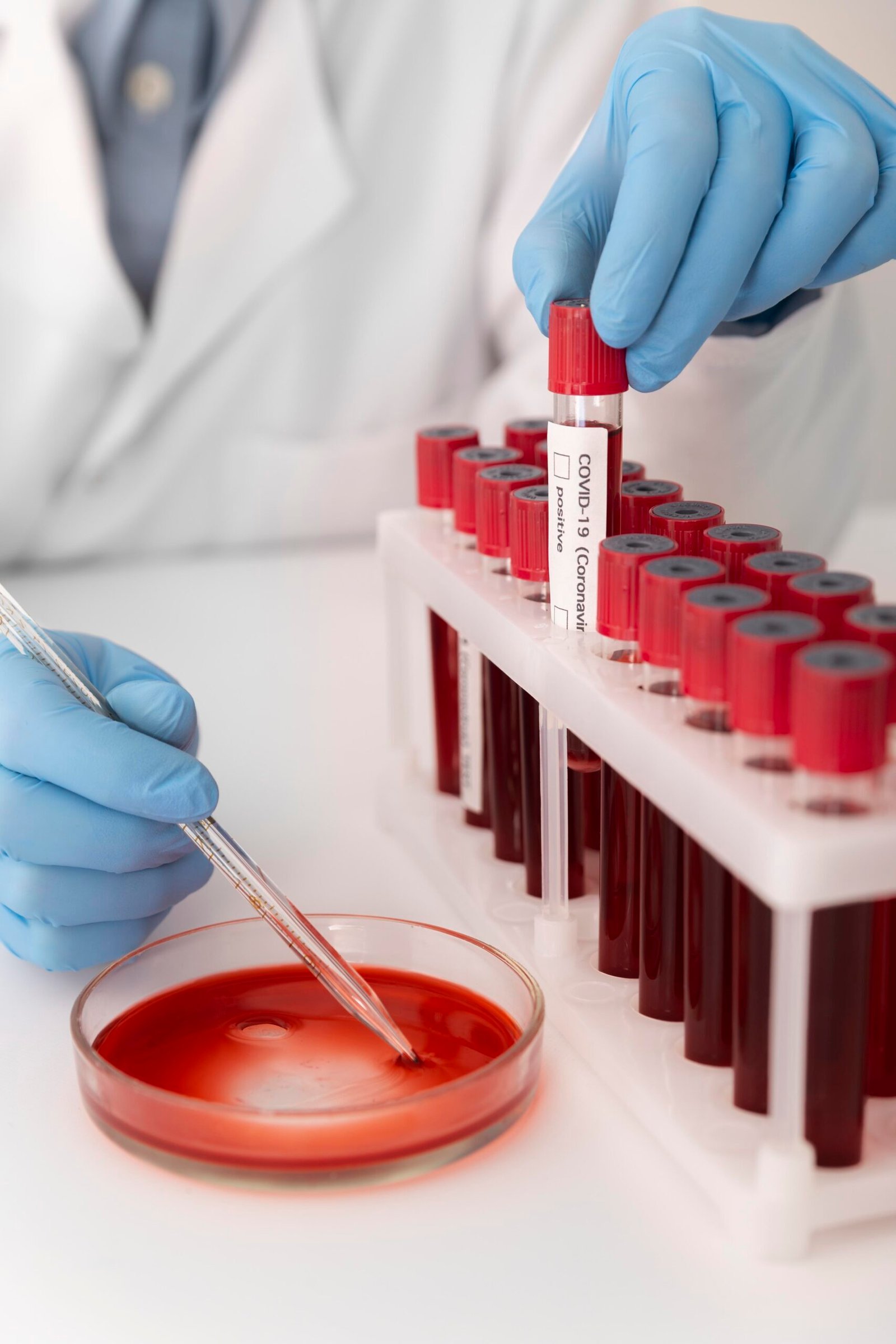 coronavirus-blood-samples-arrangement-lab