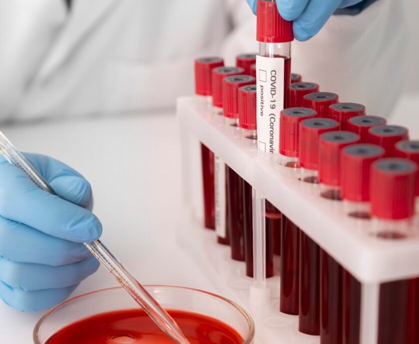 coronavirus-blood-samples-arrangement-lab